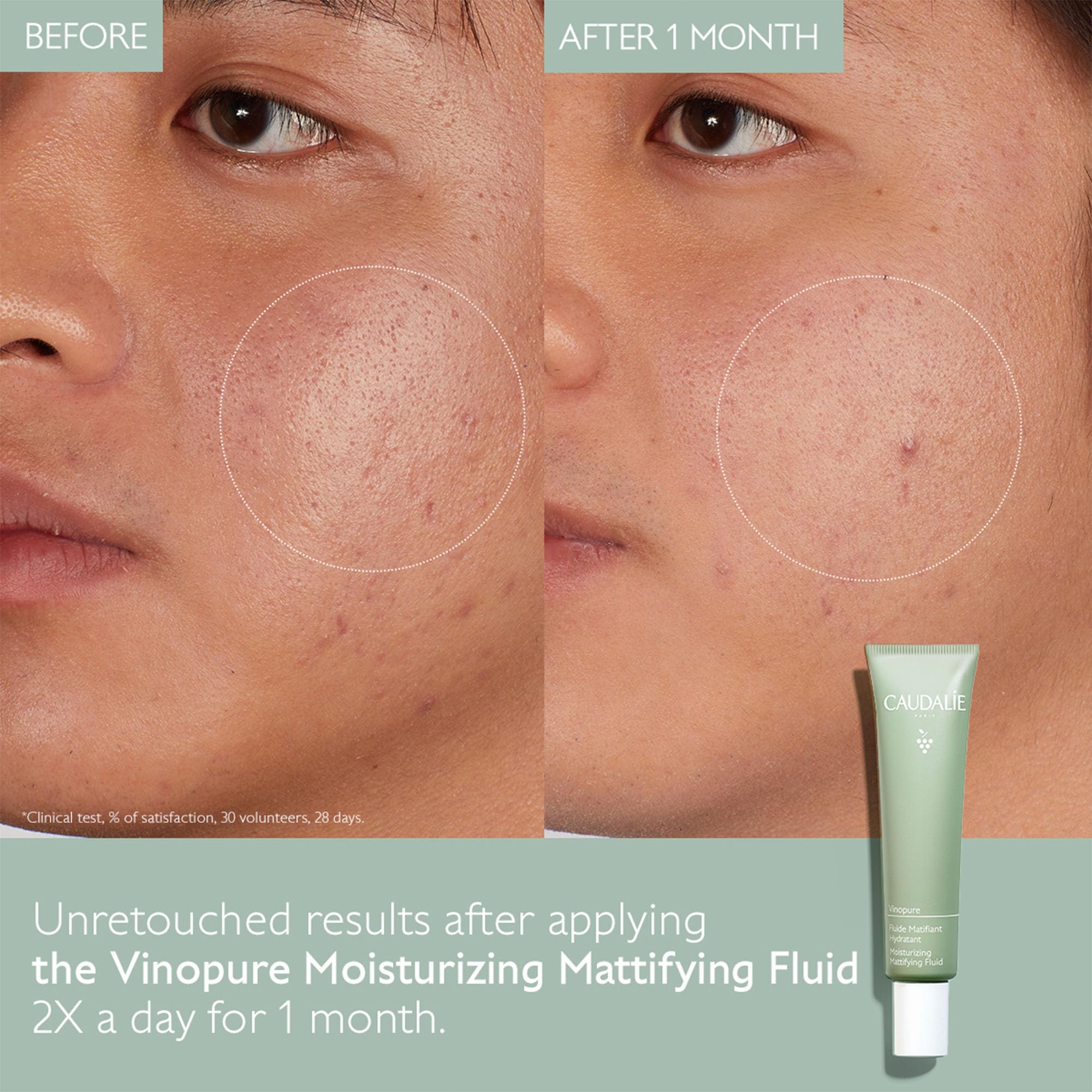 Caudalie Vinopure Oil Control Moisturizer for Acne Prone Skin, Hydrating & Mattifying Moisturizer, 1.35 Fl Oz